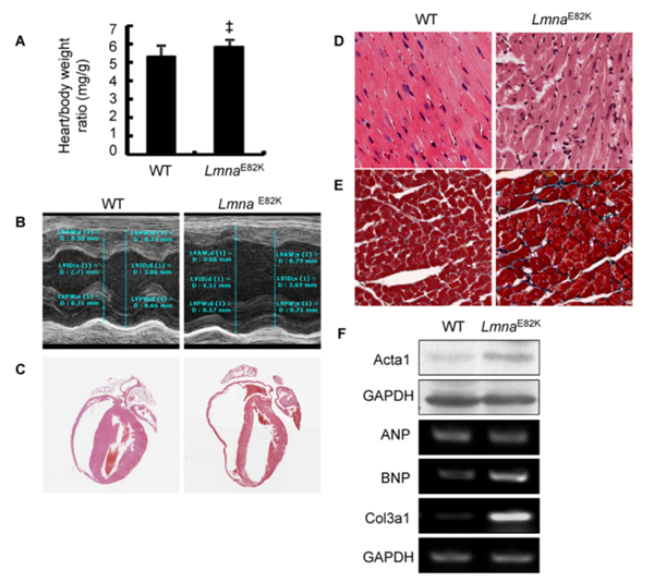 lmna e82k转基因小鼠心肌细胞凋亡显著增加(图3 5.67 2.
