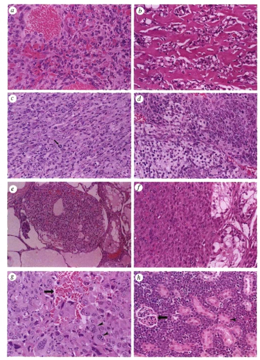 皮下血管肉瘤(subcutaneous haemangiosarcomab